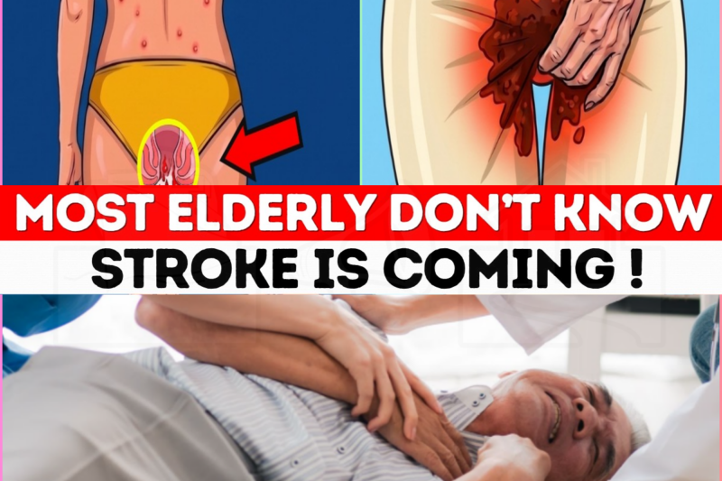 The 7 Warning Signs of a Mini-Stroke (TIA) That Most People Dismiss